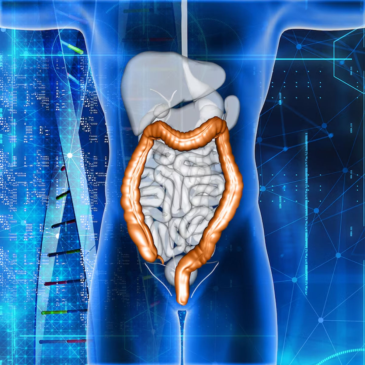 diverticulitis diet, high fibre foods, gut health
